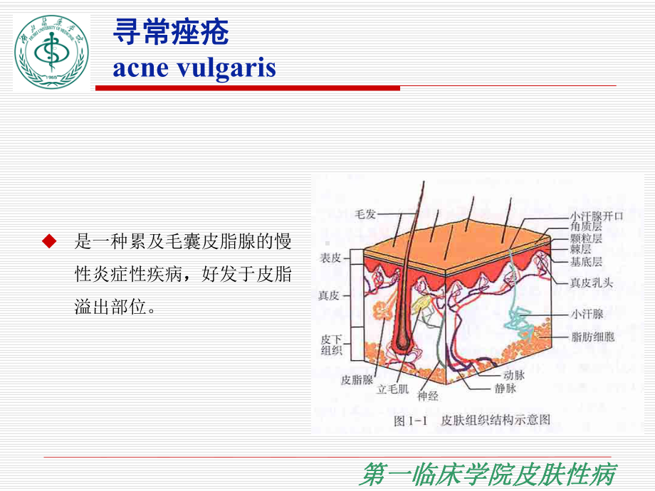 医学精品课件：痤疮.ppt_第3页