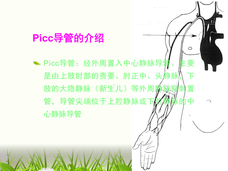 Picc导管的维护课件完整.ppt_第2页