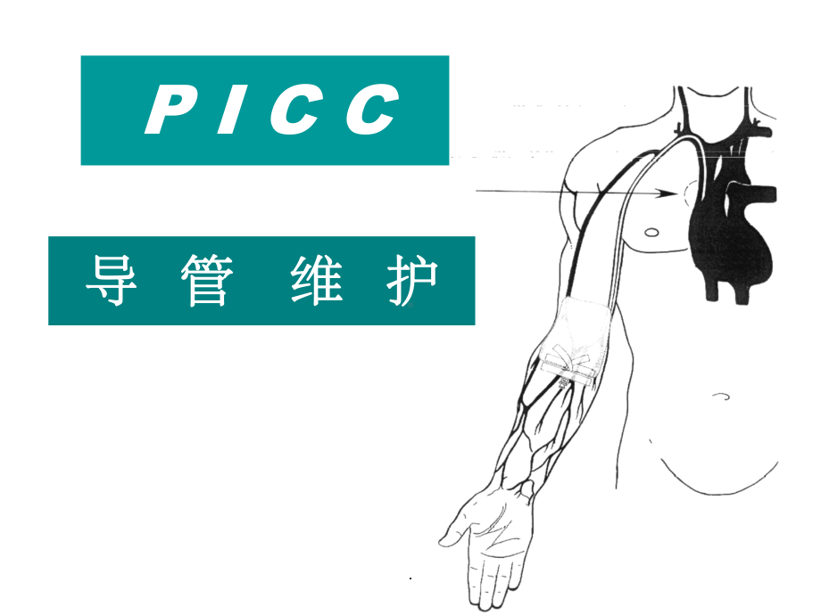 PICC导管维护详细.ppt_第1页