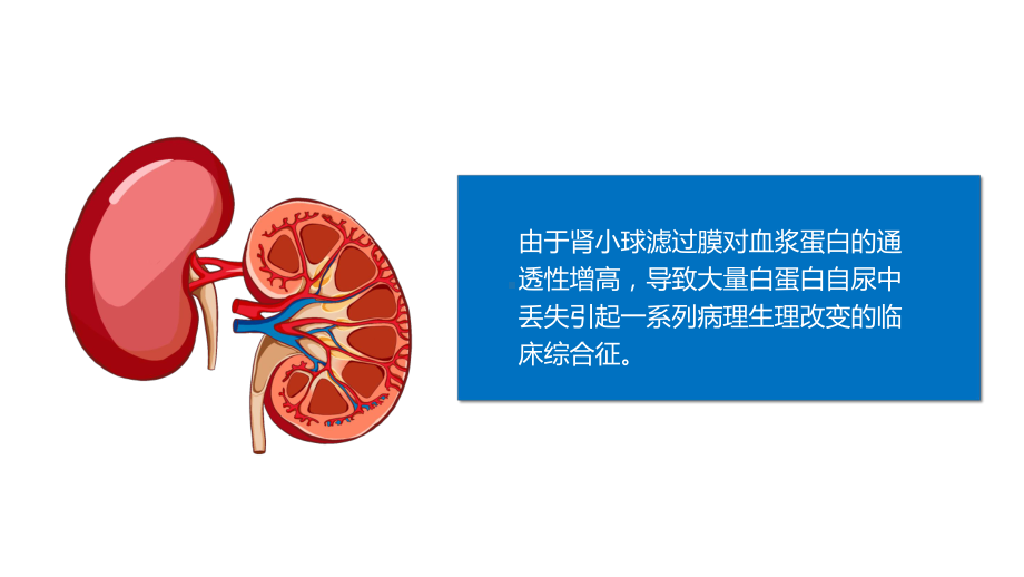 医疗原发性肾病综合征护理查房教学动态（ppt）.pptx_第2页