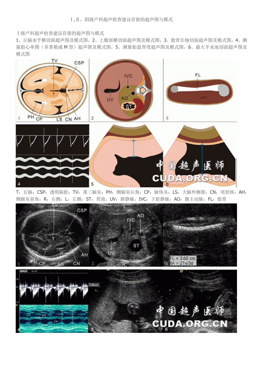 资料-Ⅰ,ⅡⅢ级产科超声检查建议存留的超声图与模式图.doc_第1页