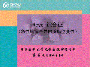 Reye 综合征.ppt