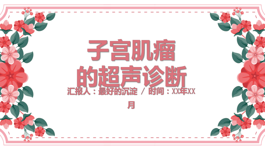 子宫肌瘤的超声诊断.pptx_第1页