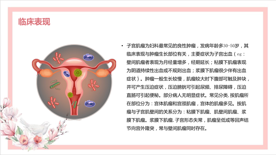 子宫肌瘤的超声诊断.pptx_第3页