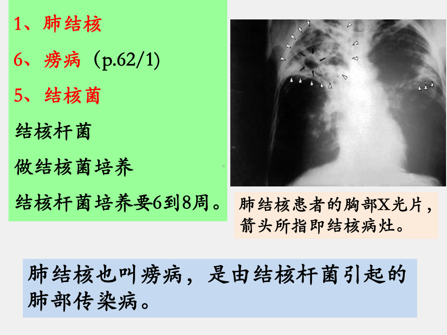 《医学汉语》课件第三册第七课（肺结核）.pptx_第3页