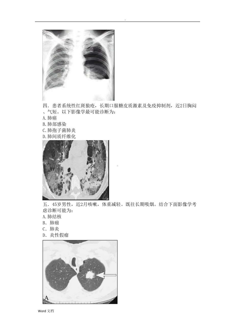 呼吸内科：辅助检查结果判断试题(DOC 12页).doc_第2页