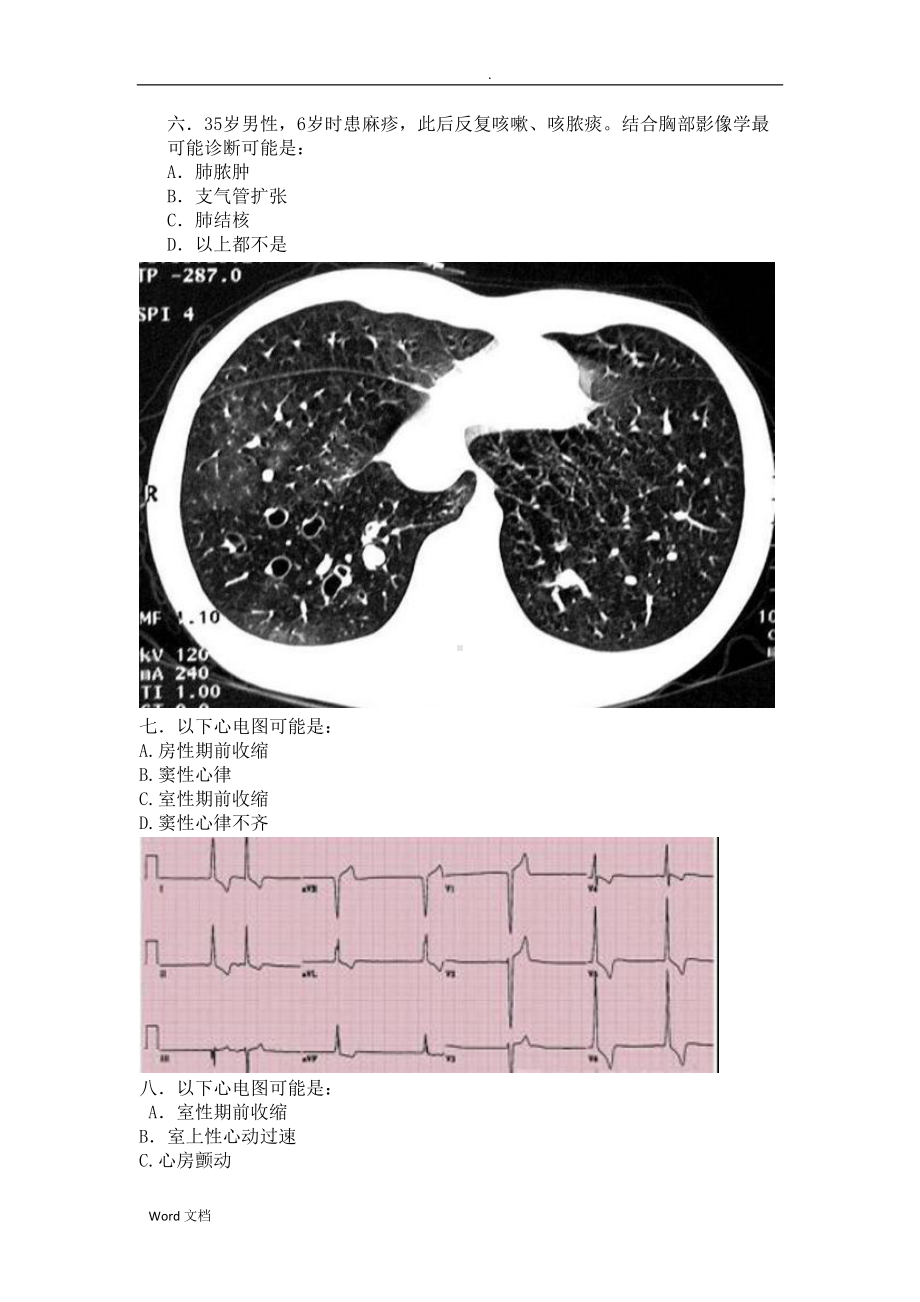 呼吸内科：辅助检查结果判断试题(DOC 12页).doc_第3页