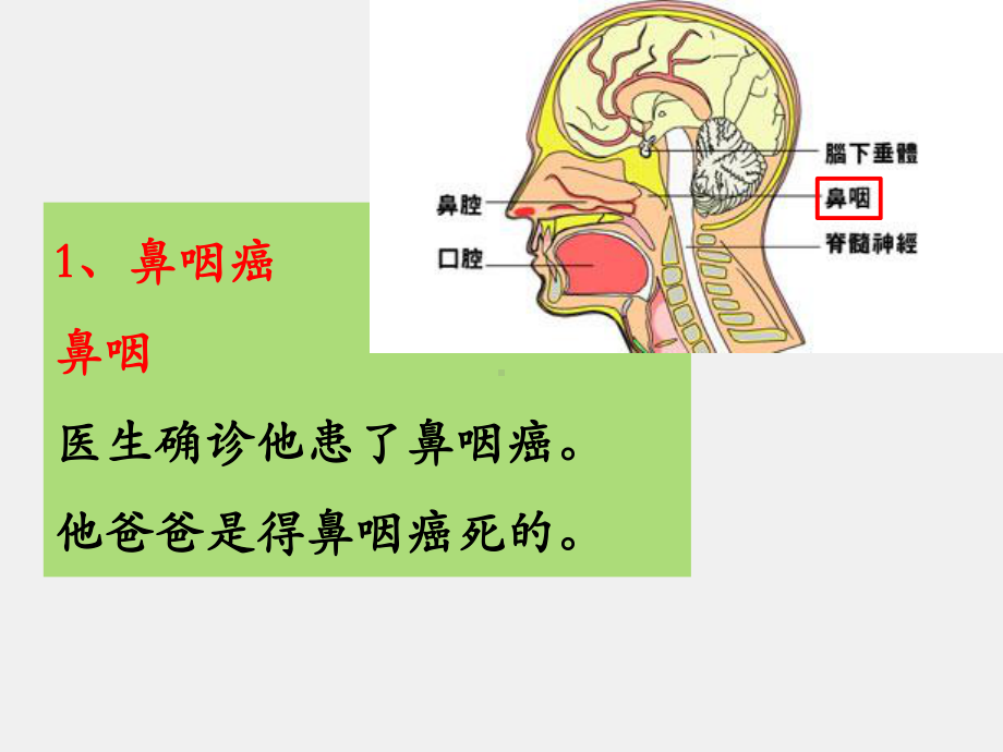 《医学汉语》课件第三册第八课（鼻咽癌）.pptx_第3页