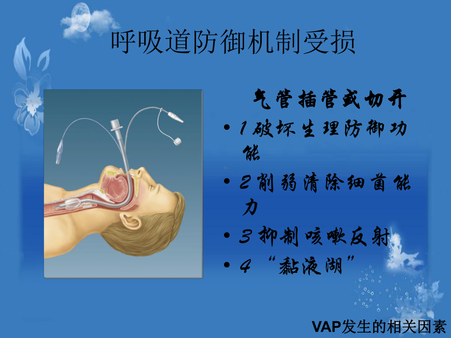 VAp预防护理课件.ppt_第3页