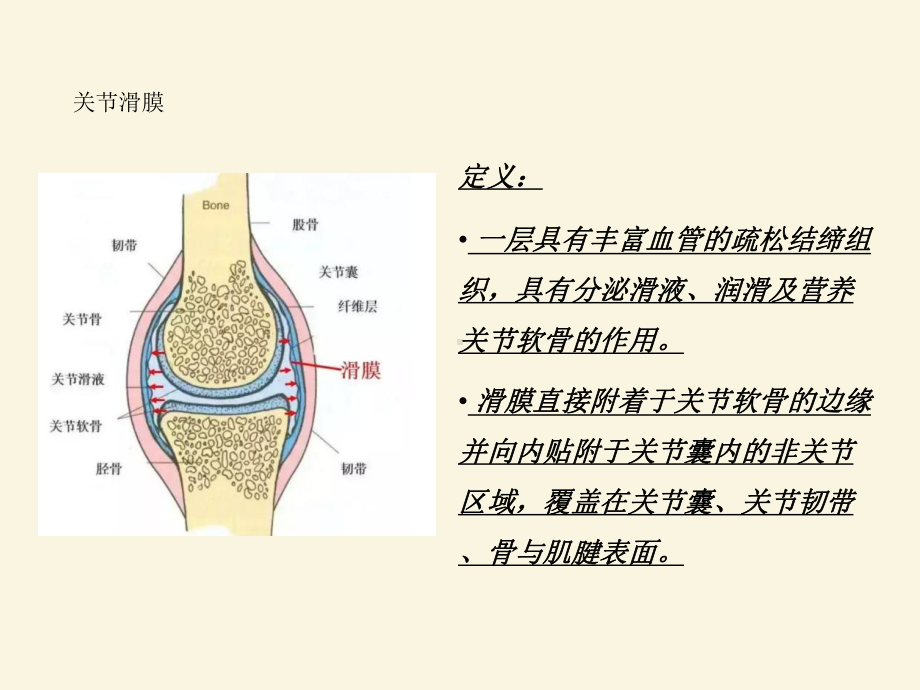 T2WI低信号的滑膜病变课件.ppt_第2页