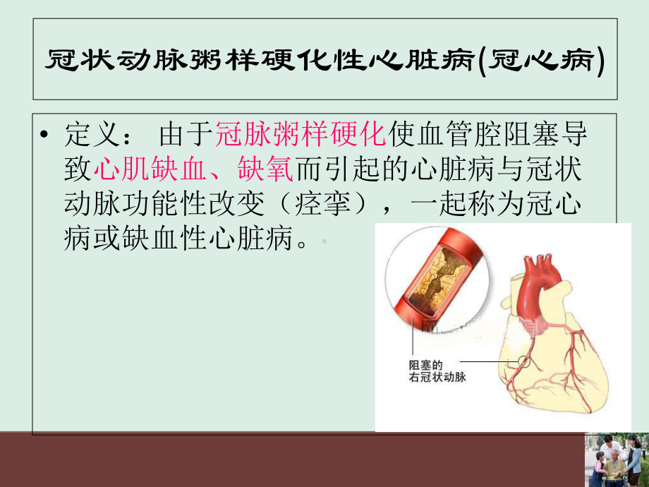 PCI术护理查房培训课件.ppt_第2页