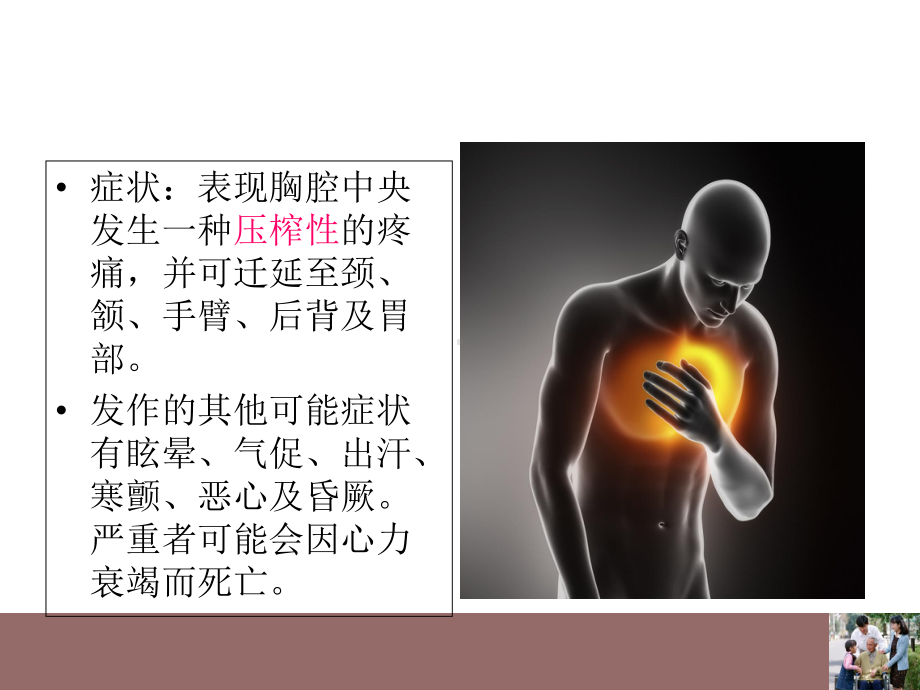 PCI术护理查房培训课件.ppt_第3页