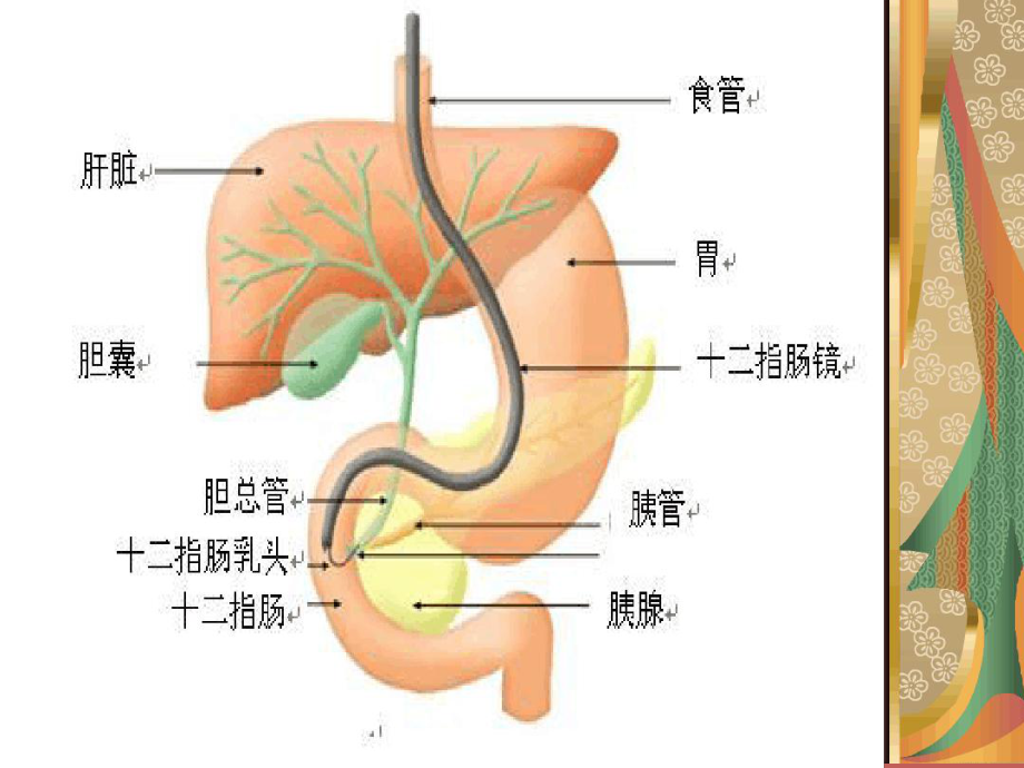 ERCP术护理教学讲解课件.ppt_第3页