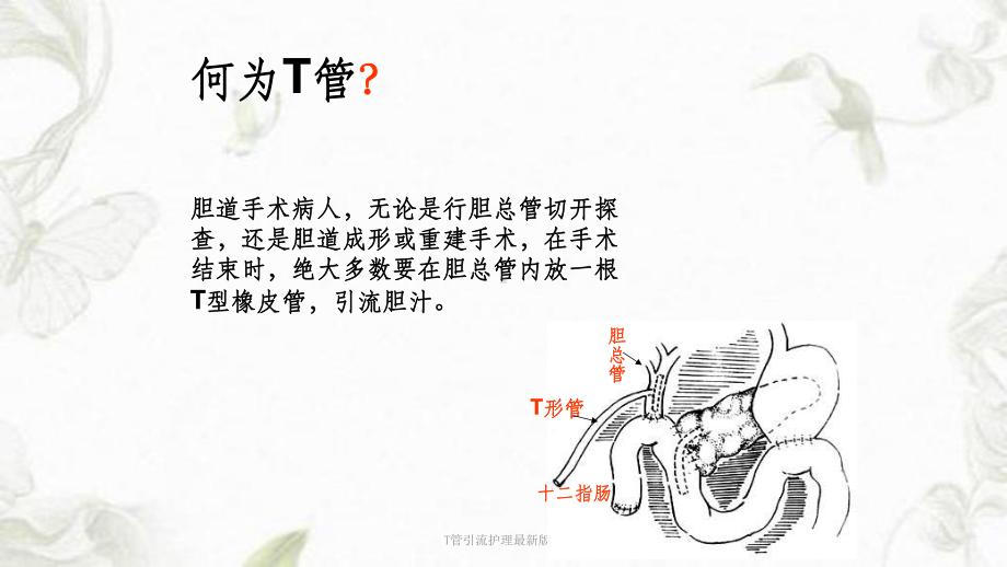 T管引流护理最新版本课件.ppt_第3页