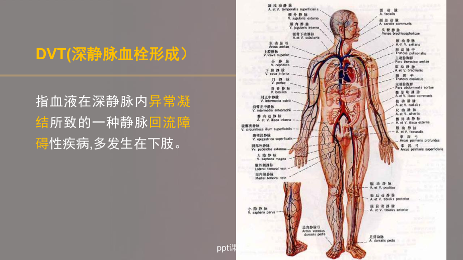 dvt的预防及护理-课件.ppt_第2页