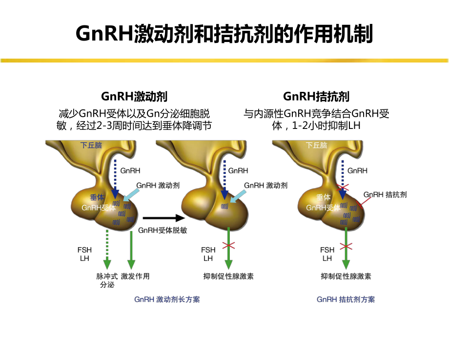 GnRH拮抗剂方案共识课件.pptx_第3页