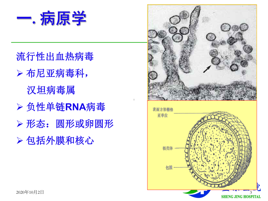 传染病-流行性出血热课件.ppt_第3页