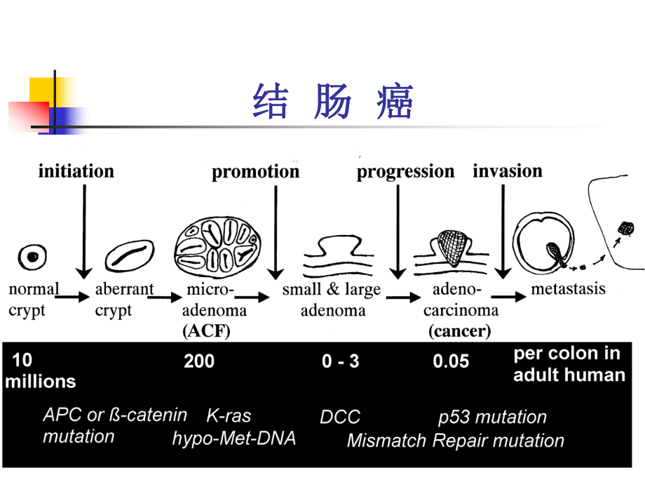 （教学讲解课件）-结肠癌.ppt_第2页