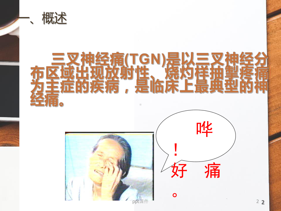 三叉神经痛-课件.ppt_第2页