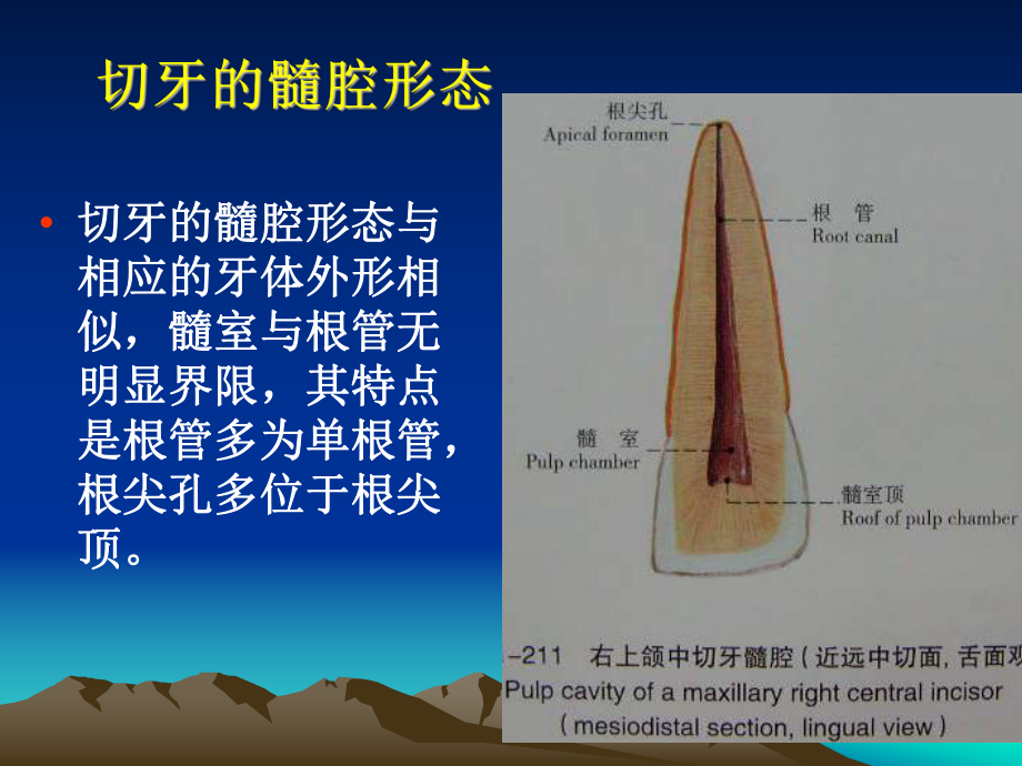 下颌侧切牙髓腔形态课件.ppt_第1页