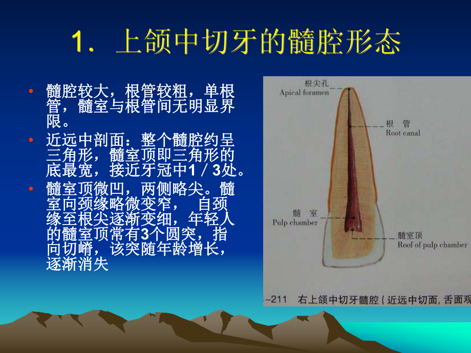 下颌侧切牙髓腔形态课件.ppt_第2页