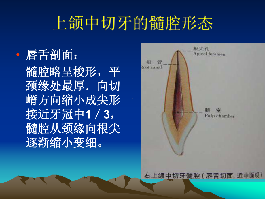 下颌侧切牙髓腔形态课件.ppt_第3页