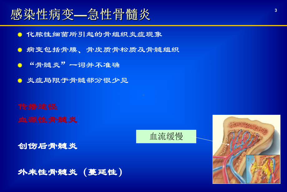 关节炎-浙江大学课件.ppt_第3页