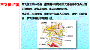 三叉神经痛病人的护理课件.pptx