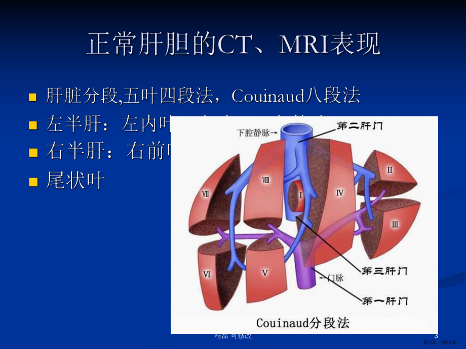 肝脏常见原发肿瘤的CTMRI表现精品课件.pptx_第3页