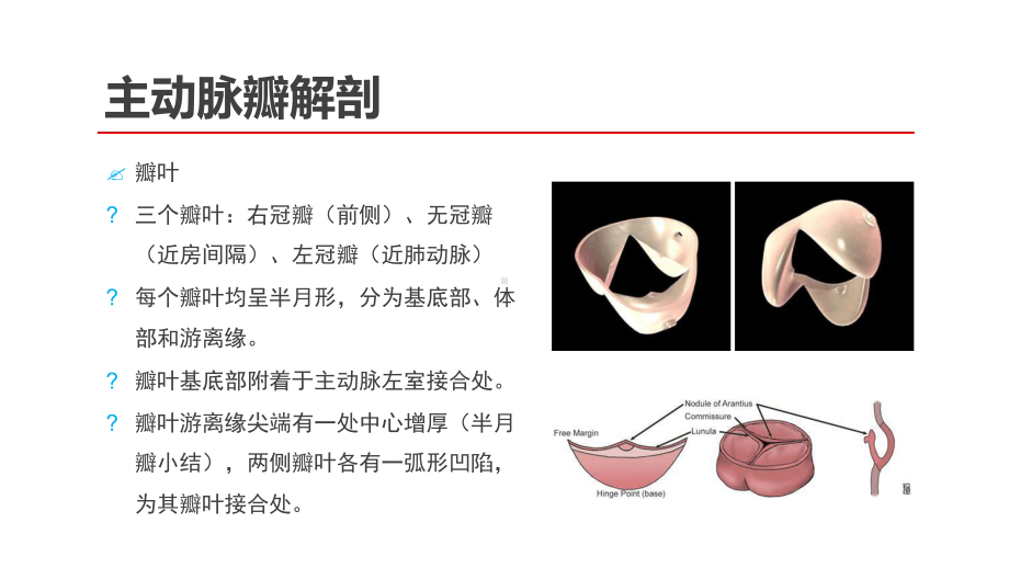 主动脉瓣狭窄及关闭不全的超声诊断课件.ppt_第3页