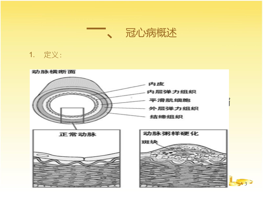 冠状动脉粥样硬化性心脏病护理-课件.ppt_第3页