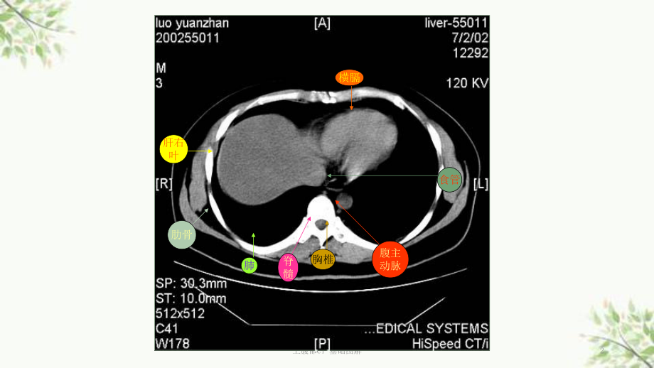 上腹部CT-基础图解课件.ppt_第2页