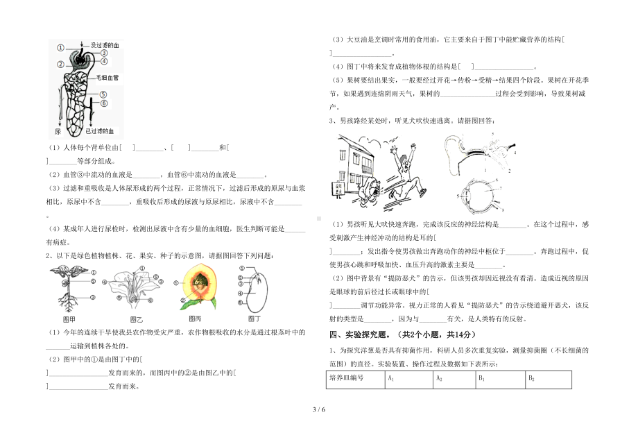 新人教版七年级下册《生物》期末测试卷（带答案）(DOC 6页).doc_第3页