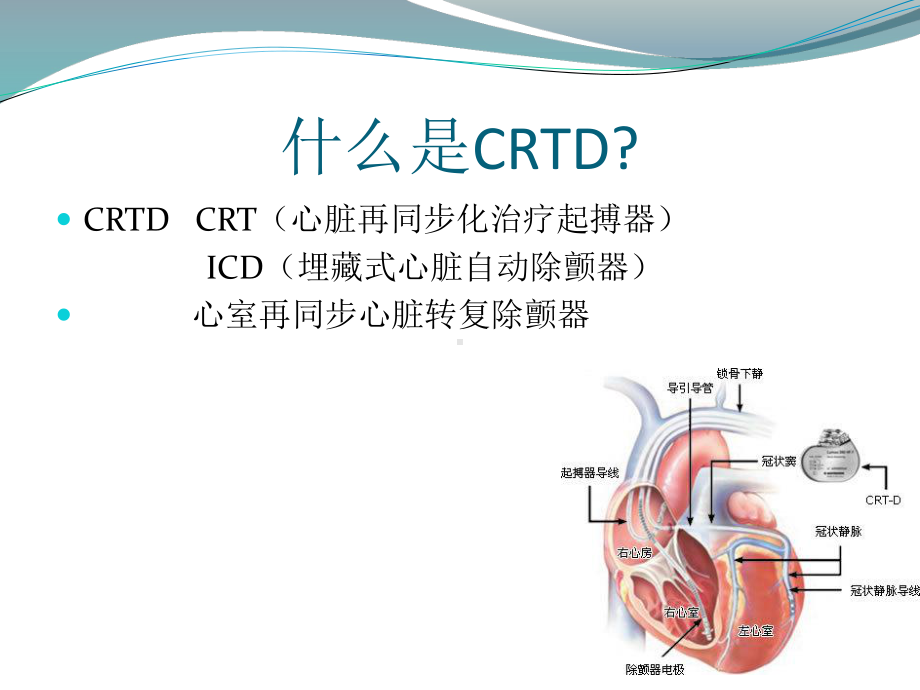 CRTD的护理教学讲解课件.ppt_第3页