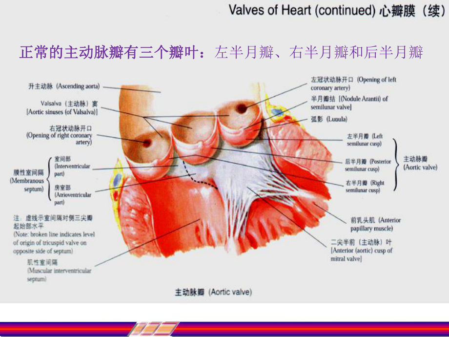 主动脉瓣置换、升主动脉置换术护理查房-课件.ppt_第2页