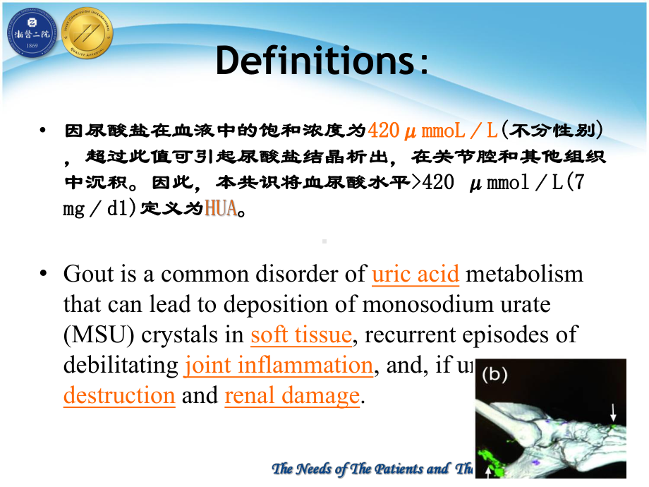 尿酸氧化酶降尿酸药物课件.ppt_第2页