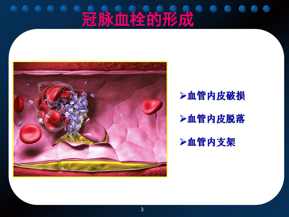 抗血小板药物知识课件.ppt_第3页