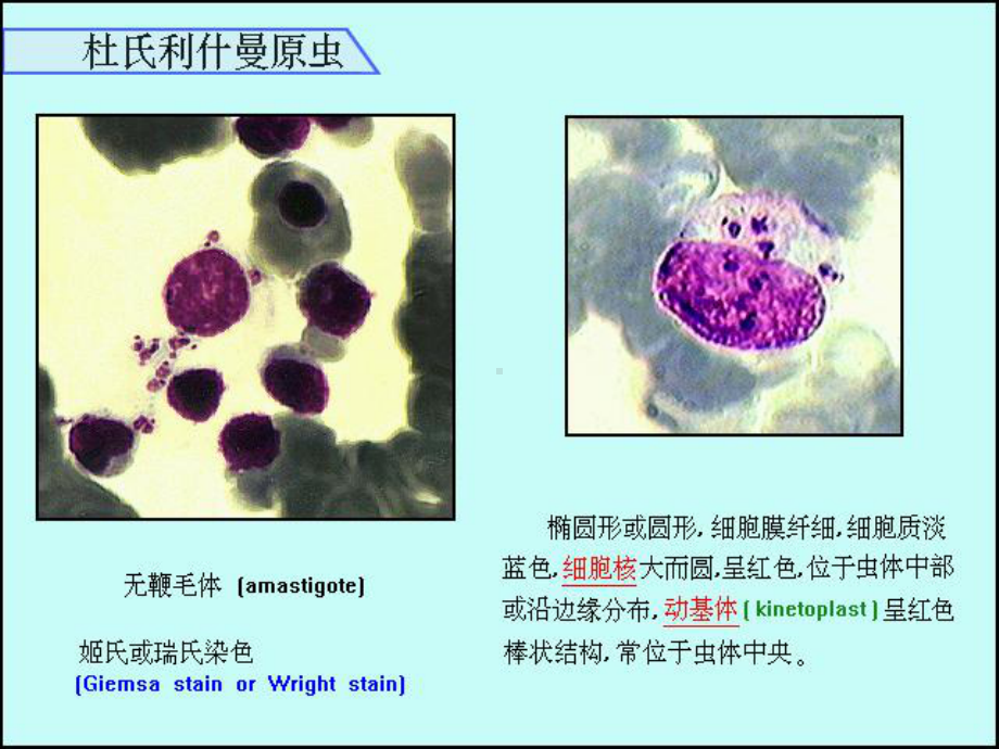 利什曼原虫杜氏利什曼原虫内脏利什曼病课件.ppt_第3页