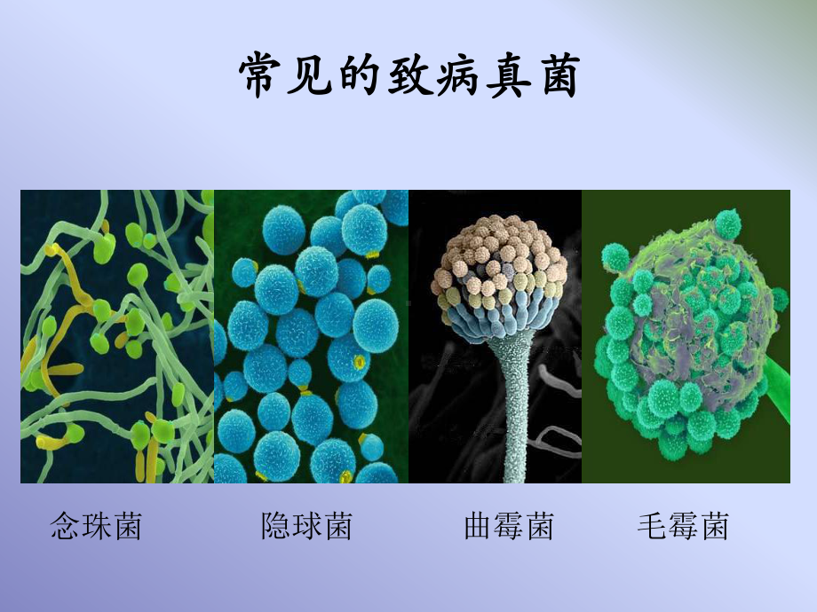 常用抗真菌药物的特点课件.ppt_第2页