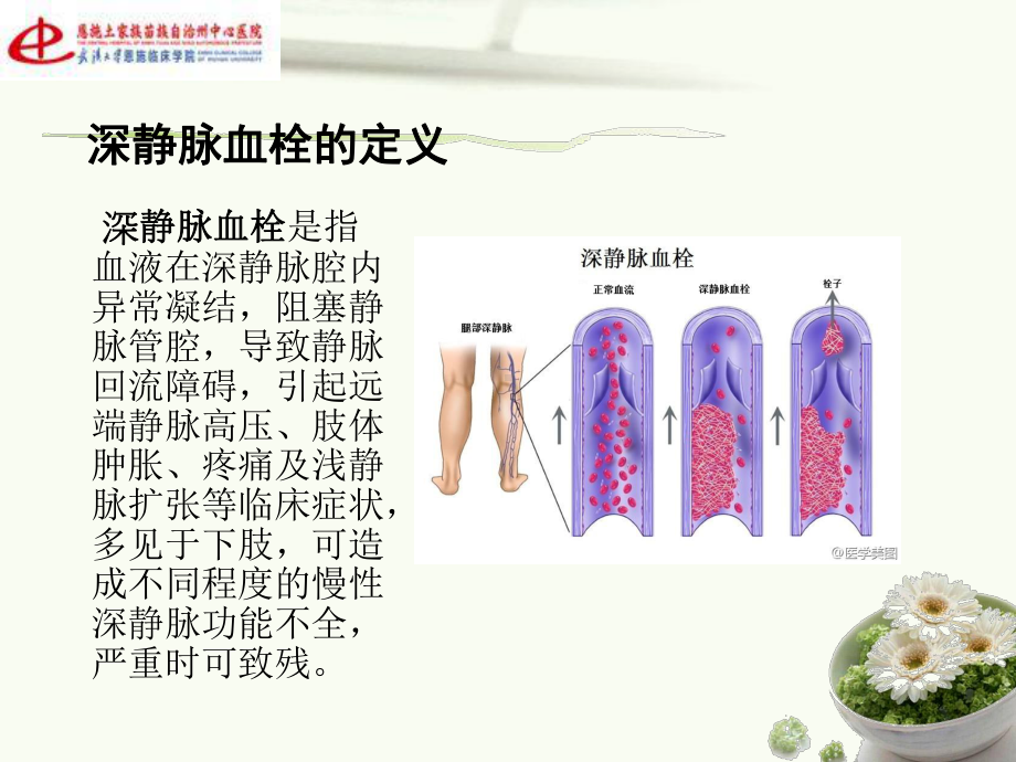 医学运用PDCA管理降低深静脉血栓的发生率课件.ppt_第2页