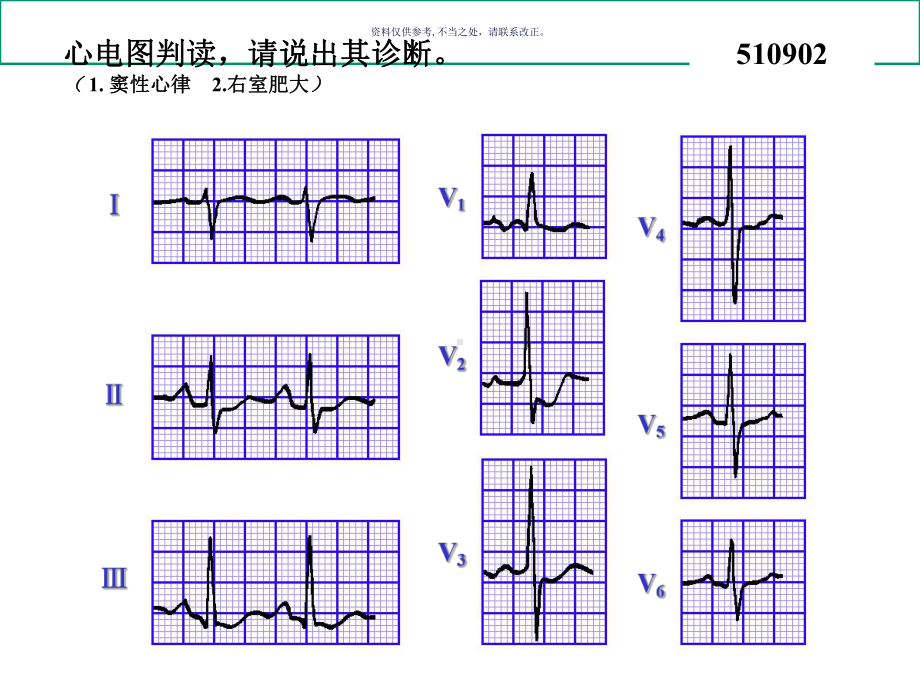 心电图试题和答案课件.ppt_第1页