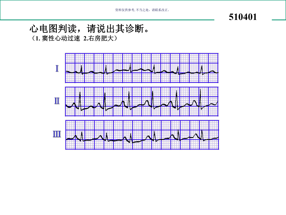 心电图试题和答案课件.ppt_第3页