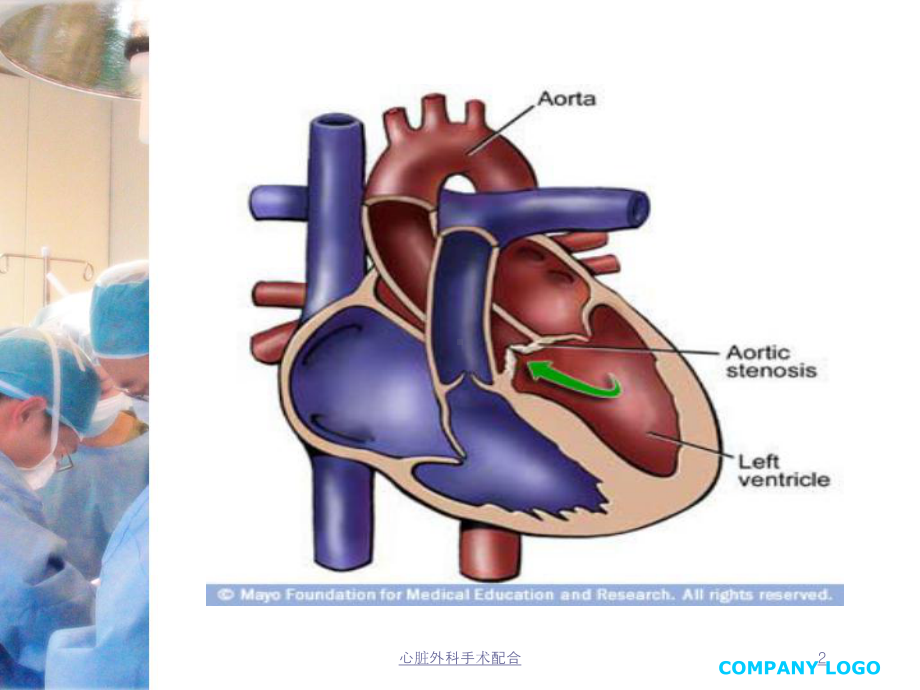 心脏外科手术配合培训课件.ppt_第2页