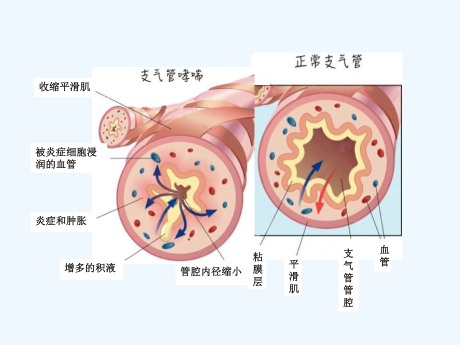 平喘药物分类与用药知识课件.ppt_第2页