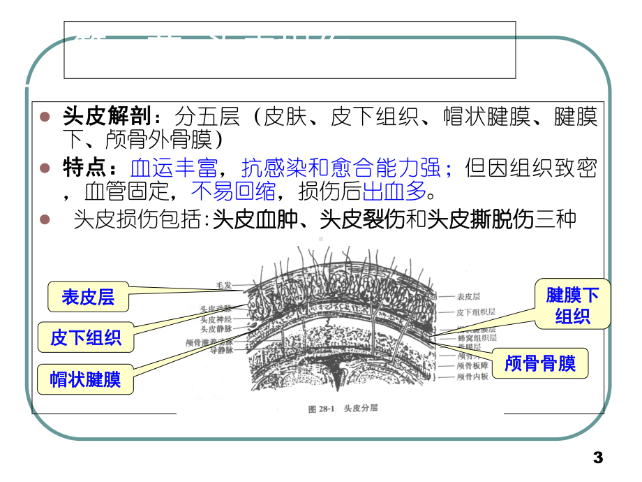 医学课件颅脑损伤病人的护理讲义.ppt_第3页