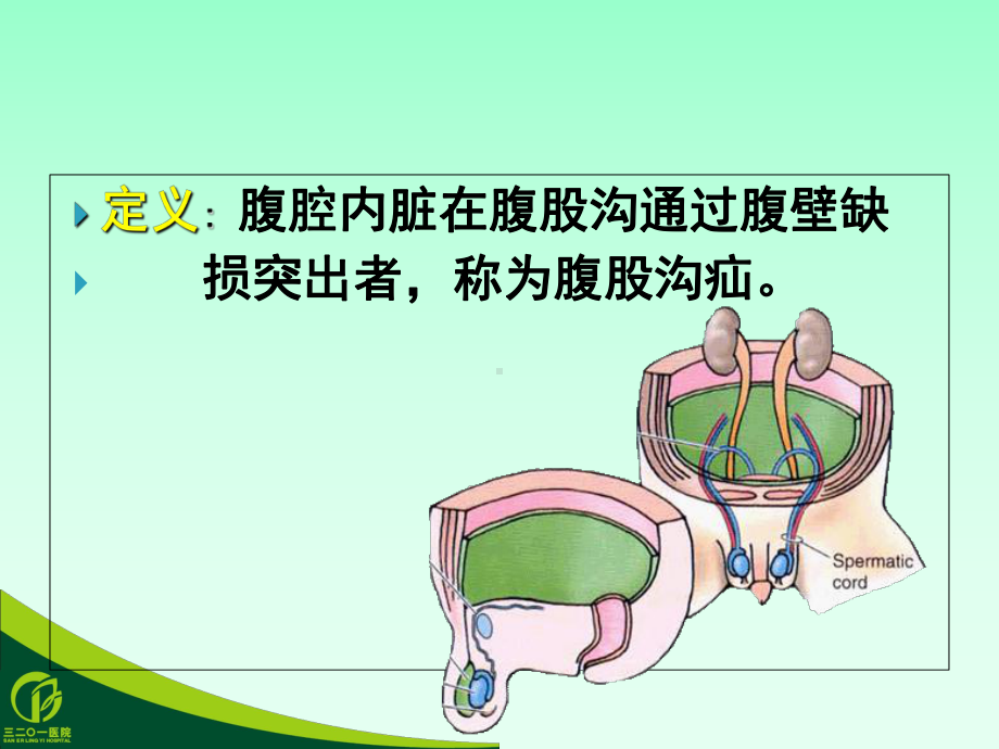 医学腹腔镜小儿腹股沟疝培训课件.ppt_第2页