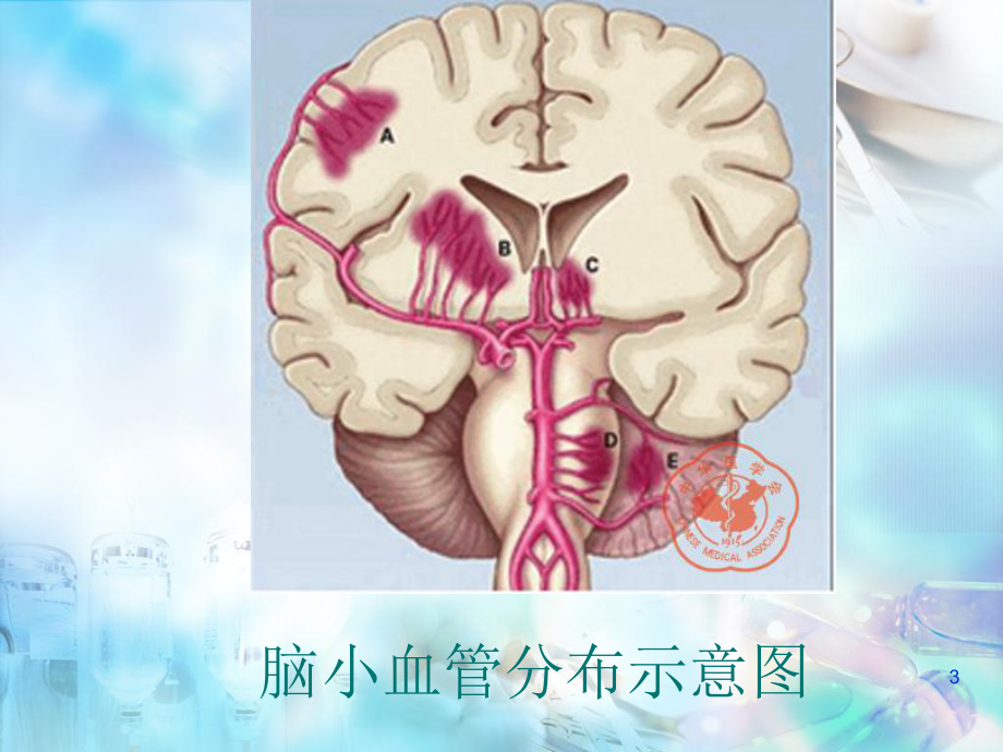 医学课件-脑小血管病教学课件.ppt_第3页