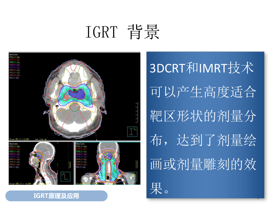 图像引导放疗原理应用和QA优质课件.pptx_第3页