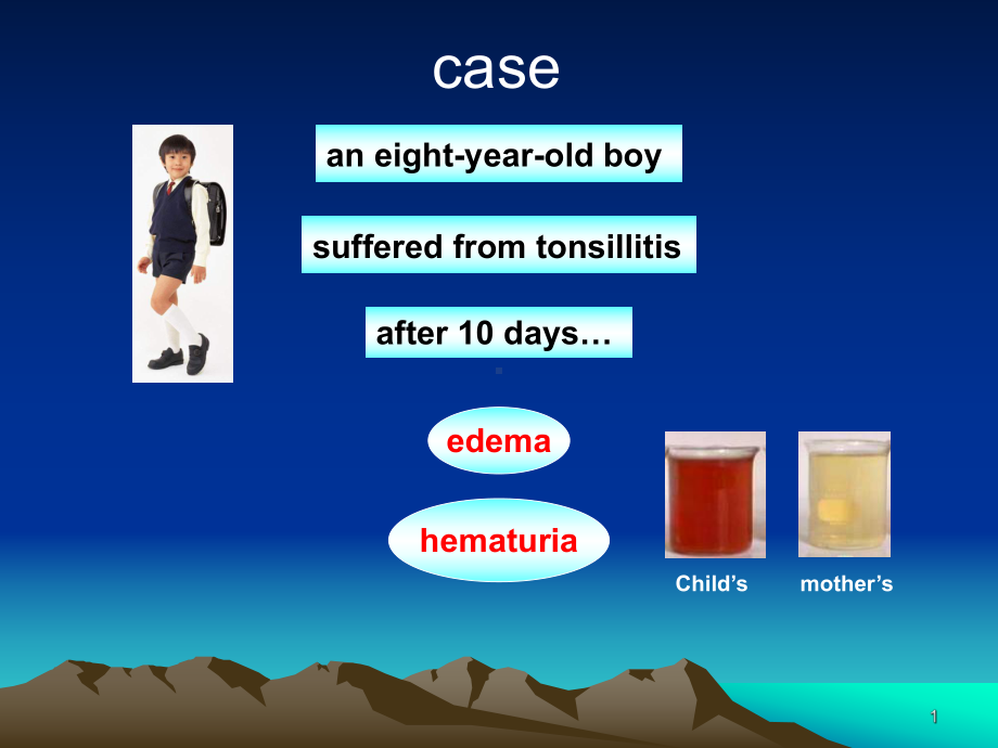 急性肾小球肾炎讲课课件.ppt_第1页