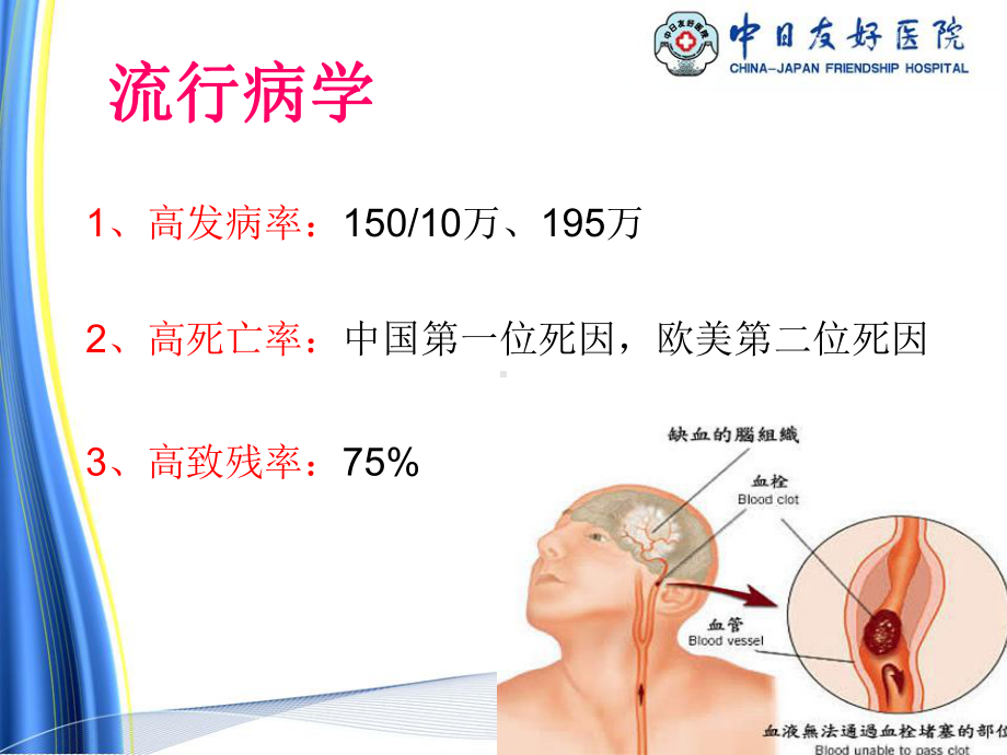 医学静脉溶栓的护理培训课件.ppt_第2页